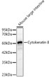 Western blot analysis of lysates from Mouse large intestine, using Cytokeratin 8 Rabbit polyclonal antibody (STJ11105320) at 1:1000 dilution. Secondary antibody: HRP Goat Anti-Rabbit IgG (H+L) (STJS000856) at 1:10000 dilution. Lysates/proteins: 25ug per lane. Blocking buffer: 3% nonfat dry milk in TBST. Detection: ECL Basic Kit. Exposure time: 10s.