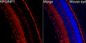 Perform high pressure antigen retrieval with 10 mM citrate buffer pH 6. 0 before commencing with IF staining protocol. Immunofluorescence analysis of mouse eye cells using RPGRIP1 Rabbit polyclonal antibody (STJ11105383) at dilution of 1:200 (40x lens). Blue: DAPI for nuclear staining.