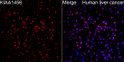 Immunofluorescence analysis of human liver cancer cells using KIAA1456 Rabbit polyclonal antibody (STJ11105387) at dilution of 1:200 (40x lens). Perform high pressure antigen retrieval with 10 mM citrate buffer pH 6. 0 before commencing with IF staining protocol. Secondary antibody: Cy3 Goat Anti-Rabbit IgG (H+L) at 1:500 dilution. Blue: DAPI for nuclear staining.