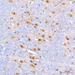 Immunohistochemistry analysis of KIAA1456 in paraffin-embedded Rat brain tissue using KIAA1456 Rabbit polyclonal antibody (STJ11105387) at a dilution of 1:200 (40x lens). High pressure antigen retrieval was performed with 0. 01 M citrate buffer (pH 6. 0) prior to immunohistochemistry staining.