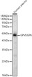Western blot analysis of Human plasma, using GPVI/GP6 Rabbit polyclonal antibody (STJ11105391) at 1:2000 dilution. Secondary antibody: HRP Goat Anti-Rabbit IgG (H+L) (STJS000856) at 1:10000 dilution. Lysates/proteins: 25ug per lane. Blocking buffer: 3% nonfat dry milk in TBST. Detection: ECL Basic Kit. Exposure time: 90s.