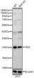 Western blot analysis of lysates from wild type (WT) and Bad knockdown (KD) 293T (KD) cells, using Bad Rabbit polyclonal antibody (STJ11105422) at 1:500 dilution. Secondary antibody: HRP Goat Anti-Rabbit IgG (H+L) (STJS000856) at 1:10000 dilution. Lysates/proteins: 25ug per lane. Blocking buffer: 3% nonfat dry milk in TBST. Detection: ECL Basic Kit. Exposure time: 180s.