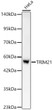 Western blot analysis of lysates from HeLa cells, using TRIM21 Rabbit monoclonal antibody (STJ11105437) at 1:1000 dilution. Secondary antibody: HRP Goat Anti-Rabbit IgG (H+L) (STJS000856) at 1:10000 dilution. Lysates/proteins: 25ug per lane. Blocking buffer: 3% nonfat dry milk in TBST. Detection: ECL Basic Kit. Exposure time: 45s.