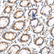 Immunohistochemistry analysis of MRPL21 in paraffin-embedded human colon tissue using [KD Validated] MRPL21 Rabbit polyclonal antibody (STJ11105472) at a dilution of 1:100 (40x lens). High pressure antigen retrieval was performed with 0. 01 M citrate buffer (pH 6. 0) prior to immunohistochemistry staining.