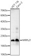 Western blot analysis of various lysates using MRPL21 Rabbit polyclonal antibody (STJ11105472) at 1:1000 dilution. Secondary antibody: HRP Goat Anti-Rabbit IgG (H+L) (STJS000856) at 1:10000 dilution. Lysates/ proteins: 25 Mu g per lane. Blocking buffer: 3 % nonfat dry milk in TBST. Detection: ECL Basic Kit. Exposure time: 90s.