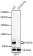 Western blot analysis of lysates from 293T cells using FGFR3 Rabbit polyclonal antibody (STJ11105489) at 1:400 dilution. Secondary antibody: HRP Goat Anti-Rabbit IgG (H+L) (STJS000856) at 1:10000 dilution. Lysates/proteins: 25  Mu g per lane. Blocking buffer: 3% nonfat dry milk in TBST. Detection: ECL Basic Kit. Exposure time: 90s.