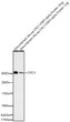 Western blot analysis of recombinant mouse CXCL1/GRO-alpha Protein using CXCL1 Rabbit monoclonal antibody (STJ11105527) at 1:1000 dilution. Secondary antibody: HRP Goat Anti-Rabbit IgG (H+L) (STJS000856) at 1:10000 dilution. Lysates/proteins: 5ng/1ng per lane. Blocking buffer: 3% nonfat dry milk in TBST. Detection: ECL Basic Kit. Exposure time: 90s.