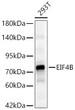 Western blot analysis of lysates from 293T cells using [KO Validated] EIF4B Rabbit polyclonal antibody (STJ11105552) at 1:1000 dilution. Secondary antibody: HRP Goat Anti-Rabbit IgG (H+L) (STJS000856) at 1:10000 dilution. Lysates/proteins: 25  Mu g per lane. Blocking buffer: 3% nonfat dry milk in TBST. Detection: ECL Basic Kit. Exposure time: 60s.