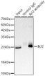 Immunoprecipitation of Bcl2 in 300 µg extracts from mouse lung using 3 µg Bcl2 Rabbit polyclonal antibody (STJ11105559). Western blot analysis was performed using Bcl2 Rabbit polyclonal antibody (STJ11105559) at 1:500 dilution.