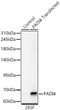 Western blot analysis of lysates from wild type (WT) and 293F cells transfected with PADI4 using PADI4 Rabbit polyclonal antibody (STJ11105566) at 1:1000 dilution. Secondary antibody: HRP Goat Anti-Rabbit IgG (H+L) (STJS000856) at 1:10000 dilution. Lysates/proteins: 25  Mu g per lane. Blocking buffer: 3% nonfat dry milk in TBST. Detection: ECL Basic Kit. Exposure time: 90s.