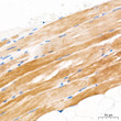 Immunohistochemistry analysis of GLUT4 in paraffin-embedded Human skeletal muscle tissue using GLUT4 Rabbit polyclonal antibody (STJ11105583) at a dilution of 1:200 (40x lens). High pressure antigen retrieval was performed with 0. 01 M citrate buffer (pH 6. 0) prior to immunohistochemistry staining.