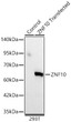 Western blot analysis of lysates from wild type (WT) and 293T cells transfected with ZNF10 using ZNF10 Rabbit polyclonal antibody (STJ11105608) at 1:1000 dilution. Secondary antibody: HRP Goat Anti-Rabbit IgG (H+L) (STJS000856) at 1:10000 dilution. Lysates/proteins: 25  Mu g per lane. Blocking buffer: 3% nonfat dry milk in TBST. Detection: ECL Basic Kit. Exposure time: 60s.