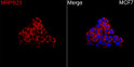 Immunofluorescence analysis of MCF7 cells using MRPS23 Rabbit polyclonal antibody (STJ11105614) at a dilution of 1:100 (40x lens). Secondary antibody: Cy3 Goat Anti-Rabbit IgG (H+L) at 1:500 dilution. Blue: DAPI for nuclear staining.