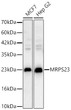 Western blot analysis of various lysates using MRPS23 Rabbit polyclonal antibody (STJ11105614) at 1:1000 dilution. Secondary antibody: HRP Goat Anti-Rabbit IgG (H+L) (STJS000856) at 1:10000 dilution. Lysates/ proteins: 25 Mu g per lane. Blocking buffer: 3 % nonfat dry milk in TBST. Detection: ECL Basic Kit. Exposure time: 1s.