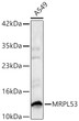 Western blot analysis of lysates from A549 cells using [KD Validated] MRPL53 Rabbit polyclonal antibody (STJ11105622) at 1:1000 dilution. Secondary antibody: HRP Goat Anti-Rabbit IgG (H+L) (STJS000856) at 1:10000 dilution. Lysates/proteins: 25  Mu g per lane. Blocking buffer: 3% nonfat dry milk in TBST. Detection: ECL Basic Kit. Exposure time: 60s.