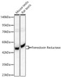 Western blot analysis of various lysates using Ferredoxin Reductase Rabbit polyclonal antibody (STJ11105628) at 1:1000 dilution. Secondary antibody: HRP Goat Anti-Rabbit IgG (H+L) (STJS000856) at 1:10000 dilution. Lysates/ proteins: 25 Mu g per lane. Blocking buffer: 3 % nonfat dry milk in TBST. Detection: ECL Basic Kit. Exposure time: 30s.