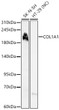 Western blot analysis of various lysates using COL1A1 Rabbit polyclonal antibody (STJ11105651) at 1:3000 dilution. Secondary antibody:HRP Goat Anti-Rabbit IgG (H+L) (STJS000856) at 1:10000 dilution. Lysates/proteins: 25  Mu g per lane. Blocking buffer: 3% nonfat dry milk in TBST. Detection:ECL Basic Kit. Negative control (NC) : HT-29. Exposuretime: 30s.