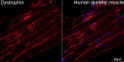 Confocal imaging of paraffin-embedded Human skeletal muscle tissue using Dystrophin Rabbit monoclonal antibody (STJ11105697, dilution 1:100) followed by a further incubation with Cy3 Goat Anti-Rabbit IgG (H+L) (dilution 1:500) (Red). DAPI was used for nuclear staining (Blue). High pressure antigen retrieval performed with 0. 01M Citrate Buffer (pH 6. 0) prior to IF staining. Objective: 40x.