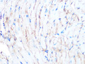 Immunohistochemistry analysis of Dystrophin in paraffin-embedded mouse heart using Dystrophin Rabbit monoclonal antibody (STJ11105697) at dilution of 1:100 (40x lens). Perform microwave antigen retrieval with 10 mM PBS buffer pH 7. 2 before commencing with immunohistochemistry staining protocol.