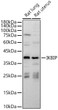 Western blot analysis of various lysates using IKBIP Rabbit polyclonal antibody (STJ11105730) at 1:2000 dilution. Secondary antibody: HRP Goat Anti-Rabbit IgG (H+L) (STJS000856) at 1:10000 dilution. Lysates/ proteins: 25 Mu g per lane. Blocking buffer: 3 % nonfat dry milk in TBST. Detection: ECL Basic Kit. Exposure time: 5s.