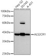 Western blot analysis of various lysates using (STJ11105758) at 1:500 dilution. <br/>Secondary antibody: HRP-conjugated Goat anti-Rabbit IgG (H+L) (STJS000856) at 1:10000 dilution. <br/>Lysates/proteins: 25 Mu g per lane. <br/>Blocking buffer: 3% nonfat dry milk in TBST. <br/>Detection: ECL Basic Kit <br/>Exposure time: 10s.