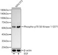 Western blot analysis of lysates from NIH/3T3 cells, using Phospho-p70 S6 Kinase 1-S371 Rabbit pAb (STJ11105784) at 1:400 dilution. NIH/3T3 cells were treated by EGF (100 ng/ml) at 37 °C for 30 minutes after serum-starvation overnight. <br/>Secondary antibody: HRP-conjugated Goat anti-Rabbit IgG (H+L) (STJS000856) at 1:10000 dilution. <br/>Lysates/proteins: 25 Mu g per lane. <br/>Blocking buffer: 3% nonfat dry milk in TBST. <br/>Detection: ECL Basic Kit <br/>Exposure time: 60s.