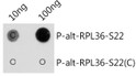 Dot-blot analysis of all sorts of peptides using Phospho-alt-RPL36-S22 antibody (STJ11105798) at 1:1000 dilution. <br/>Exposure time: 1s. Dot-blot analysis of all sorts of peptides using Phospho-alt-RPL36-S22 antibody (STJ11105798) at 1:1000 dilution. <br/>Exposure time: 1s.
