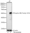Western blot analysis of lysates from C6 cells using Phospho-SRC Family-Y416 Rabbit monoclonal antibody (STJ11105850) at 1:1000 dilution. C6 cells were treated by Pervanadate (0. 5 mM) at 37 °C for 40 minutes. Secondary antibody: HRP Goat Anti-Rabbit IgG (H+L) (STJS000856) at 1:10000 dilution. Lysates/proteins: 25  Mu g per lane. Blocking buffer: 3% nonfat dry milk in TBST. Detection: ECL Basic Kit. Exposure time: 90s.