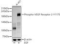 Western blot analysis of A-431 lysates, using Phospho-VEGF Receptor 2-Y1175 antibody (STJ11105860) at 1:3000 dilution. A-431 cells were treated by EGF (100 ng/ml) at 37 °C for 30 minutes after serum-starvation overnight. Secondary antibody: HRP Goat Anti-Rabbit IgG (H+L) (STJS000856) at 1:10000 dilution. Lysates/proteins: 25 Mu g per lane. Blocking buffer: 3% nonfat dry milk in TBST. Detection: ECL Basic Kit. Exposure time: 90s.