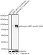 Western blot analysis of lysates from 293F cells using Phospho-AKT2 specific-S474 Rabbit polyclonal antibody (STJ11105868) at 1:900 dilution. 293F cells, 293F cells transfected with AKT3 and 293F cells transfected with AKT2 were treated by Calyculin A (50 nM) at 37 °C for 30 minutes after serum-starvation overnight. Secondary antibody: HRP Goat Anti-Rabbit IgG (H+L) (STJS000856) at 1:10000 dilution. Lysates/proteins: 25  Mu g per lane. Blocking buffer: 3% nonfat dry milk in TBST. Detection: ECL Basic Kit. Exposure time: 1s.