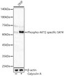 Western blot analysis of lysates from 293F cells using Phospho-AKT2 specific-S474 Rabbit polyclonal antibody (STJ11105868) at 1:900 dilution. 293F cells were treated by Calyculin A (50 nM) at 37 °C for 30 minutes after serum-starvation overnight. Secondary antibody: HRP Goat Anti-Rabbit IgG (H+L) (STJS000856) at 1:10000 dilution. Lysates/proteins: 25  Mu g per lane. Blocking buffer: 3% nonfat dry milk in TBST. Detection: ECL Basic Kit. Exposure time: 90s.