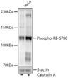 Western blot analysis of lysates from HeLa cells, using Phospho-RB-S780 Rabbit monoclonal antibody (STJ11105875) at 1:2000 dilution. HeLa cells were treated by Calyculin A (100 nM) at 37 °C for 30 minutes after serum-starvation overnight. Secondary antibody: HRP Goat Anti-Rabbit IgG (H+L) (STJS000856) at 1:10000 dilution. Lysates/proteins: 25 Mu g per lane. Blocking buffer: 3% nonfat dry milk in TBST. Detection: ECL Enhanced Kit. Exposure time: 60s.