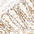 Immunohistochemistry analysis of paraffin-embedded rat colon using Phospho-CREB1-S133 Rabbit monoclonal antibody (STJ11105877) at dilution of 1:100 (40x lens). Perform high pressure antigen retrieval with 10 mM citrate buffer pH 6. 0 before commencing with immunohistochemistry staining protocol.