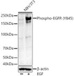 Western blot analysis of A-431 cells, using Phospho-EGFR (Y845) Rabbit monoclonal antibody (STJ11105880) at 1:800 dilution. A-431 cells were treated by EGF (200 ng/ml) at 37 °C for 30 minutes. Secondary antibody: HRP Goat Anti-Rabbit IgG (H+L) (STJS000856) at 1:10000 dilution. Lysates/proteins: 25 Mu g per lane. Blocking buffer: 3% nonfat dry milk in TBST. Detection: ECL Basic Kit. Exposure time: 180s.