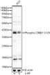 Western blot analysis of 293T, using Phospho-CREB1-S129 Rabbit polyclonal antibody (STJ11105889) at 1:400 dilution. 293T cells were treated by Lambda-PP mixed solution (1ul) at 30 °C for 30 minutes. Secondary antibody: HRP Goat Anti-Rabbit IgG (H+L) (STJS000856) at 1:10000 dilution. Lysates/proteins: 25ug per lane. Blocking buffer: 3% nonfat dry milk in TBST. Detection: ECL Basic Kit. Exposure time: 90s.