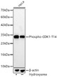 Western blot analysis of lysates from HeLa cells using Phospho-CDK1-T14 Rabbit monoclonal antibody (STJ11105900) at 1:3000 dilution. HeLa cells were treated by Hydroxyurea (4 mM) at 37 °C for 20 hours. Secondary antibody: HRP Goat Anti-Rabbit IgG (H+L) (STJS000856) at 1:10000 dilution. Lysates/proteins: 25  Mu g per lane. Blocking buffer: 3% nonfat dry milk in TBST. Detection: ECL Basic Kit. Exposure time: 60s.