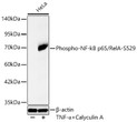 Western blot analysis of lysates from HeLa cells using Phospho-NF-kB p65/RelA-S529 Rabbit monoclonal antibody (STJ11105901) at 1:1000 dilution. HeLa cells were treated by TNF-Alpha (100 ng/ml) and Calyculin A (50 nM) at 37 °C for 30 minutes. Secondary antibody: HRP Goat Anti-Rabbit IgG (H+L) (STJS000856) at 1:10000 dilution. Lysates/proteins: 45  Mu g per lane. Blocking buffer: 3% nonfat dry milk in TBST. Detection: ECL Basic Kit. Exposure time: 45s.