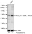 Western blot analysis of lysates from HeLa cells using Phospho-CDK2-T160 Rabbit monoclonal antibody (STJ11105902) at 1:1000 dilution. HeLa cells were treated by Nocodazole (20ng/ml). Secondary antibody:HRP Goat Anti-Rabbit IgG (H+L) (STJS000856) at 1:10000 dilution. Lysates/proteins: 25  Mu g per lane. Blocking buffer: 3% nonfat dry milk in TBST. Detection:ECL Basic Kit. Exposure time: 30s.