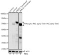 Western blot analysis of lysates from wild type (WT) 、 293F cells treated by PMA、293F cells treated by PMA after transfected with PRKCA and 293F cells treated by PMA after transfected with PRKCD using Phospho-PKC alpha-T410+PKC delta-T410 Rabbit monoclonal antibody (STJ11105905) at 1:2000 dilution. 293F、293F-PRKCA-Transfected and 293F-PRKCD-Transfected cells were treated by PMA (200 nM) at 37 °C for 30 minutes. Secondary antibody: HRP Goat Anti-Rabbit IgG (H+L) (STJS000856) at 1:10000 dilution. Lysates/proteins: 25 Mu g per lane. Blocking buffer: 3% nonfat dry milk in TBST. Detection: ECL Basic Kit. Exposure time: 90s.