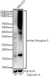 Western blot analysis of lysates from NIH/3T3 cells using Pan Phospho-T Rabbit polyclonal antibody (STJ11105908) at 1:900 dilution. NIH/3T3 cells were treated by Calyculin A (100 nM) at 37 °C for 30 minutes after serum-starvation overnight. Secondary antibody: HRP Goat Anti-Rabbit IgG (H+L) (STJS000856) at 1:10000 dilution. Lysates/proteins: 25  Mu g per lane. Blocking buffer: 3% nonfat dry milk in TBST. Detection: ECL Basic Kit. Exposure time: 180s.