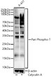 Western blot analysis of lysates from A-431 cells using Pan Phospho-T Rabbit polyclonal antibody (STJ11105908) at 1:900 dilution. A-431 cells were treated by Calyculin A (50 nM) at 37 °C for 30 minutes after serum-starvation overnight. Secondary antibody: HRP Goat Anti-Rabbit IgG (H+L) (STJS000856) at 1:10000 dilution. Lysates/proteins: 25  Mu g per lane. Blocking buffer: 3% nonfat dry milk in TBST. Detection: ECL Basic Kit. Exposure time: 180s.