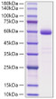 Human NBL1 protein (Recombinant) (C-hFc) (STJP001977)
