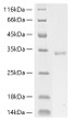 Human Collagen I alpha 1/COL1A1 protein (Recombinant) (C-His) (STJP001997)