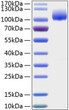 Recombinant Human Trk-A/NTRK1 Protein was determined by SDS-PAGE with Coomassie Blue, showing a band at 110-120 kDa..