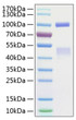 Recombinant Human HGF receptor/c-MET/MET Protein was determined by SDS-PAGE with Coomassie Blue, showing bands at 50&amp;100 kDa.
