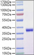 Recombinant SARS-COV-2 Spike RBD (L452R, E484Q) Protein was determined by SDS-PAGE with Coomassie Blue, showing a band at 37kDa.