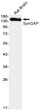 Western blot analysis of SynGAP in rat Brain lysates using SynGAP antibody.