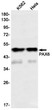 Western blot analysis of PAX6 in K562, Hela lysates using PAX6 antibody.