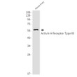 Western blot analysis of Activin A Receptor Type IB in mouse brain lysates using Activin A Receptor Type IB antibody.