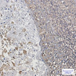 ARPC2 antibody immunohistochemistry human tonsil STJA0010984